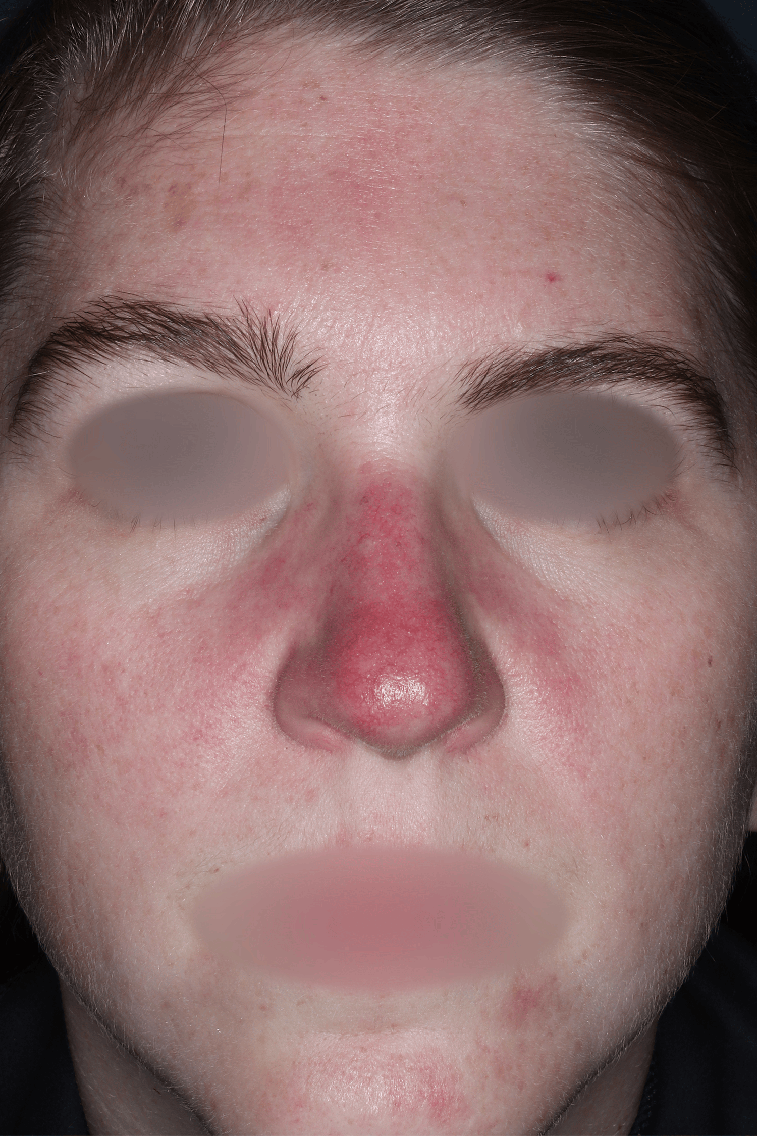 Patient C After